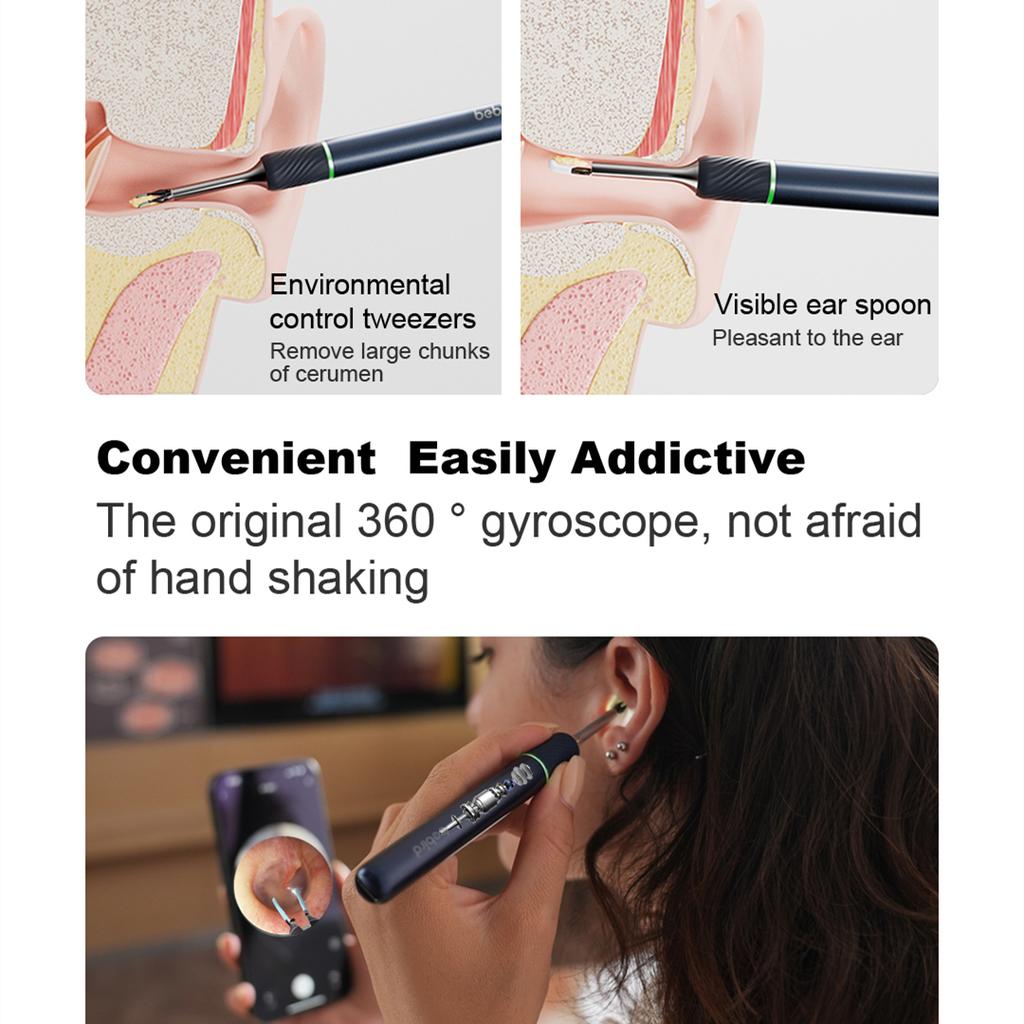 Durable And Safe Bebird Note5 Smart Visual Ear Sticks Endoscope Tweezers High Precision Earpick Mini Camera Otoscope Health Care Ear Cleaner