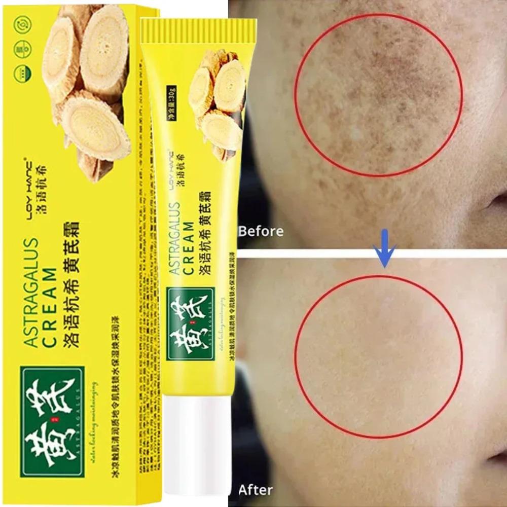 Fade Dark Spot Astragalus Cream Remove Dark Yellow Skin Moisturize Lotion Brighten Cream  Face Skin