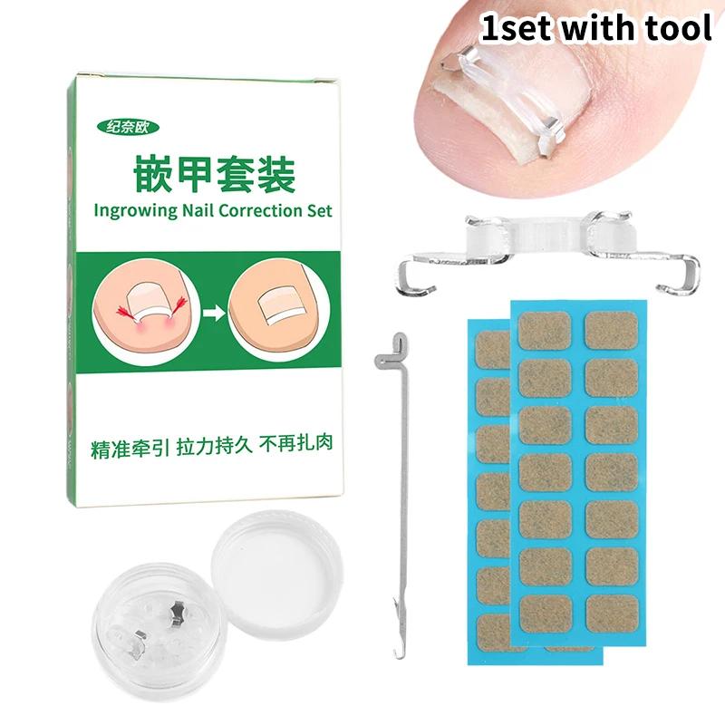 Set Tool 1/2 Ingrown Toenail Corrector Pedicure Recover Embed Treatment Professional Foot Care Correction
