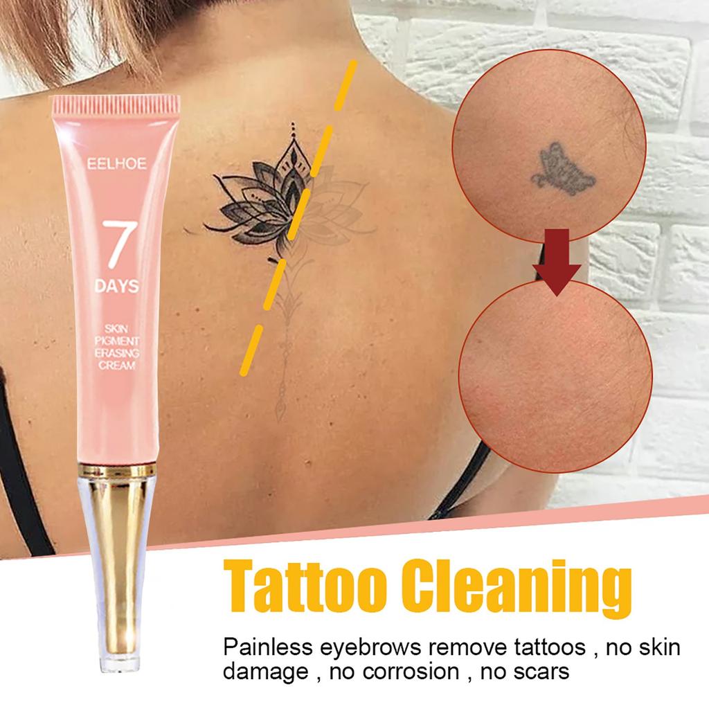  Removal  Permanent Removal Of s  Removal 