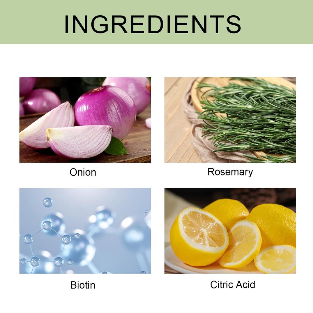 Onion Biotin Shampoo Bar Soap-Cleanse And Smooth Hair With Onion, Rosemary And Citric Acid-Moisturizes Dry, Brittle Hair, 100g