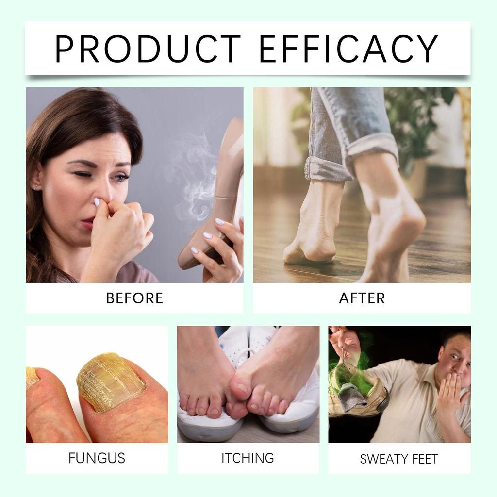 XIMONTH Pielęgnacja Stóp Nawilżająca i Odżywcza Odświeżająca i Dezodorująca Do Stóp 100ml