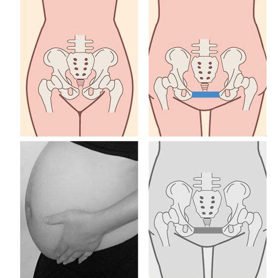 Esercitatore per cosce da donna, per allenare l'anca pelvica, attrezzatura per l'allenamento delle gambe, per il pavimento pelvico con contatore digitale, per sedere/braccia/gambe