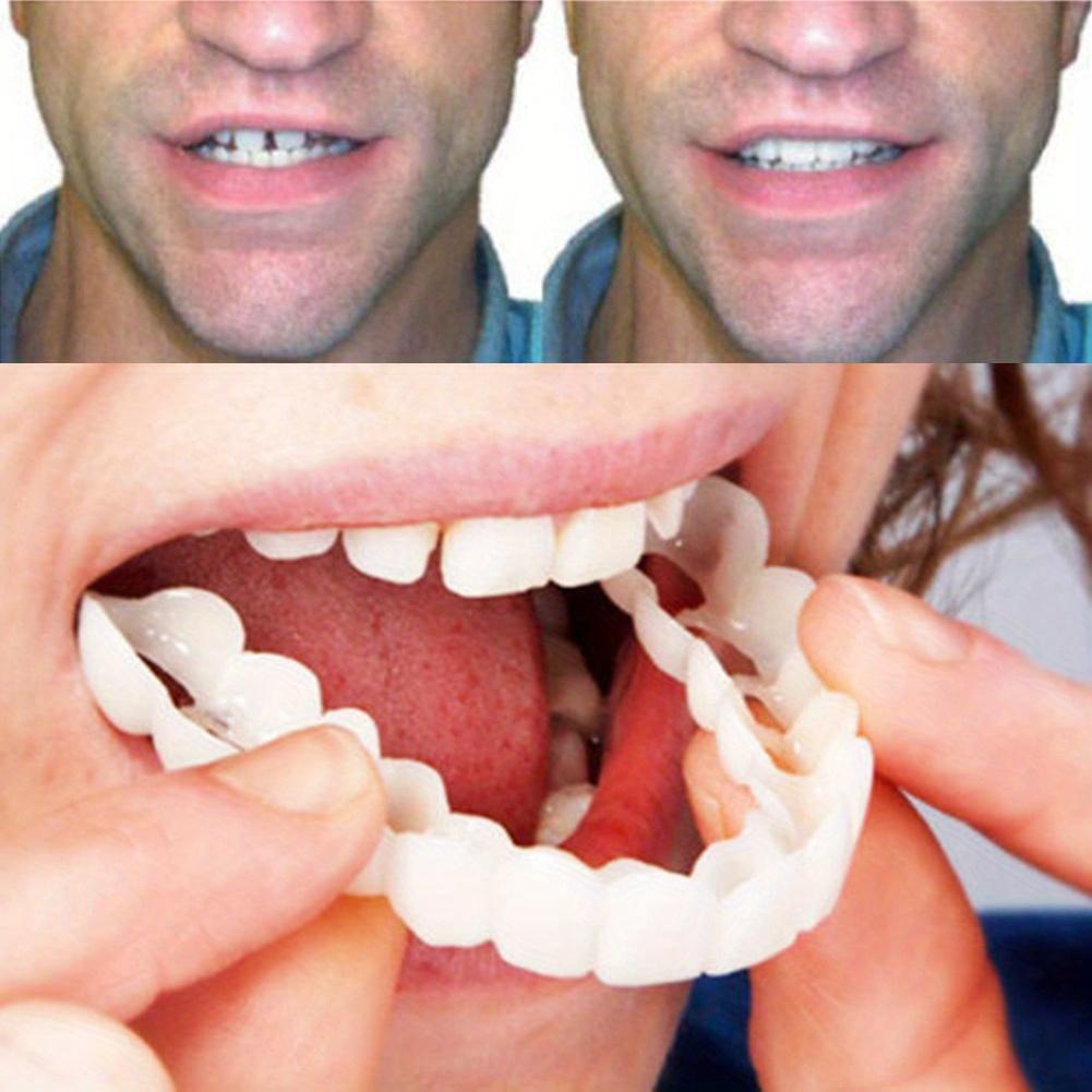Two Pairs of Replacement Denture Accessories, White Denture Veneer To Fill Interdental Holes, Suitable for Men and Women