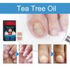 Multi-purpose Nail Care Stickers, Care For Damaged Nails, Effectively Improve The Appearance Of Damaged Fingernails And Toenails