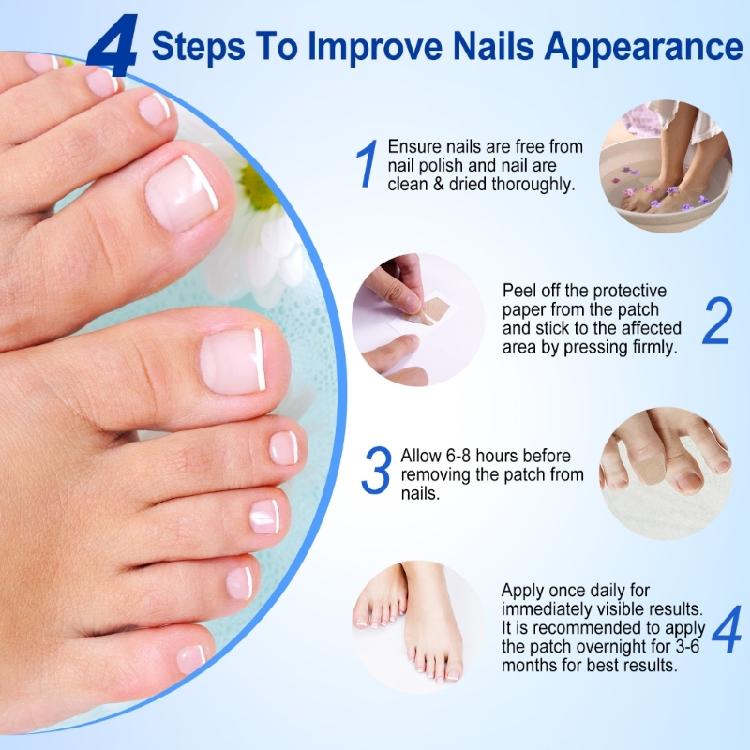 Ingrown Toenail Sticker Corrector Patches Big Toe Nail Corrector Renewal Plaster