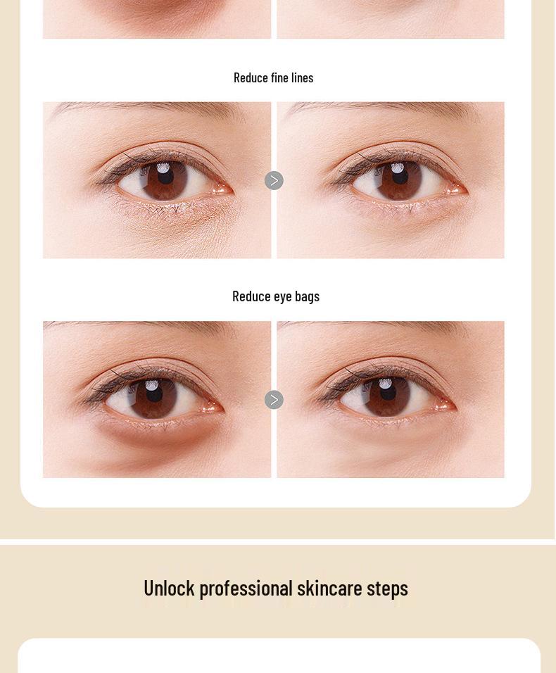Eye Serum: Reduces Wrinkles, Firms, Moisturizes, Lifts & Tightens for Early Aging and Dark Circles