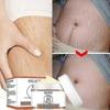 3x Stretch Marks Removal Cream Fat Growth Streaks Maternity Scars Acne Repair Increase Skin Elasticity Anti-wrinkle Firm Body Care