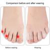 Toe Covers Transparent Silicone Toe Sleeves Breathable Toe Caps for Bunion Corns Hammer Toe Blisters Calluses