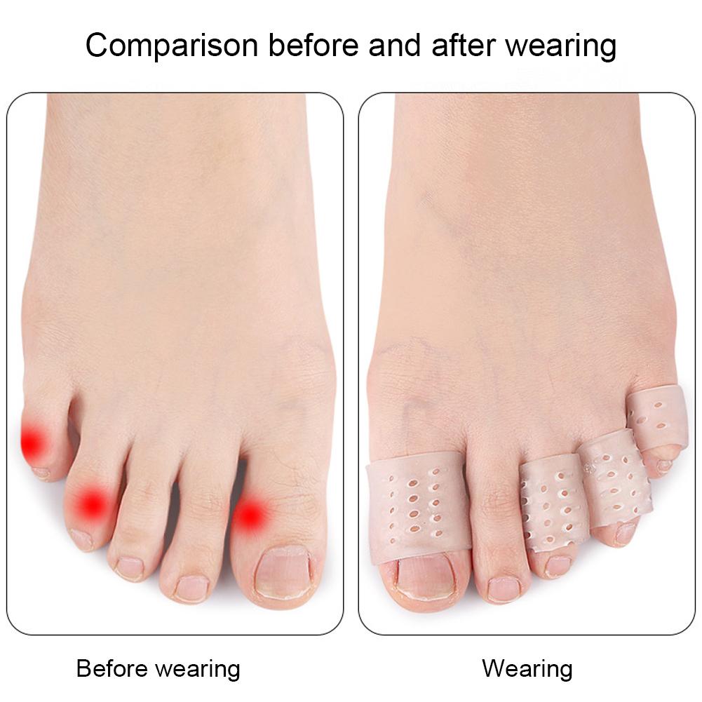 Toe Covers Transparent Silicone Toe Sleeves Breathable Toe Caps for Bunion Corns Hammer Toe Blisters Calluses