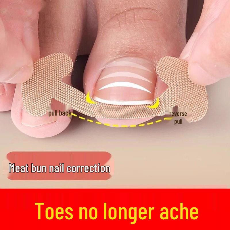 Ortopedická náplast na korekci zarostlého nehtu bez lepidla pro Lala Manicure