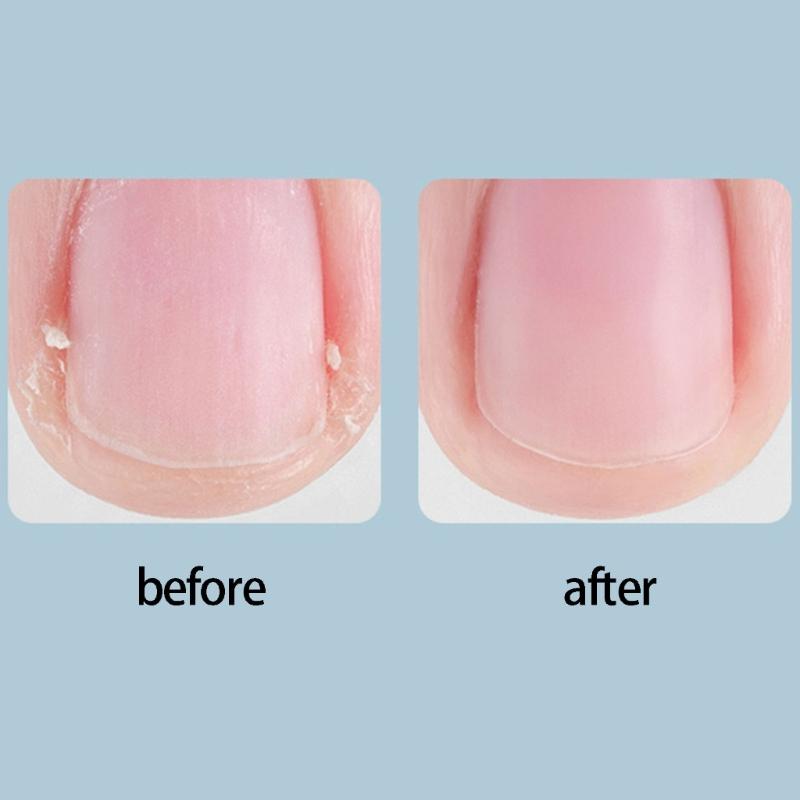 Quiet Electric Nail Trimmer Low Noise Motor USB Powered Quiet Night Use Automatic Safety Feature Baby Room