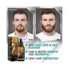 Biotin Hair Growth Spray Anti Hair Loss Fast Regrowth Scalp Treatment Serum