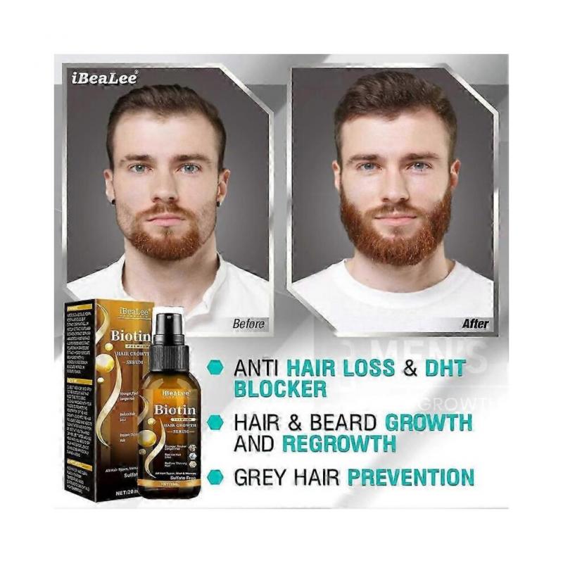 Biotin Hair Growth Spray Anti Hair Loss Fast Regrowth Scalp Treatment Serum