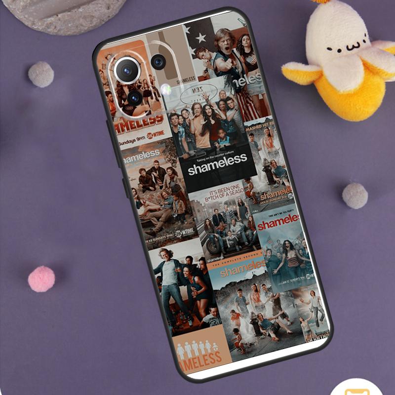 

Lip Gallagher Shameless TV Show Case For Xiaomi 17 Pro Max 14 15 Ultra 13T 14T 15T POCO F8 Ultra F5 F6 F7 X5 X6 X7 Pro Cover Xiaomi 15
