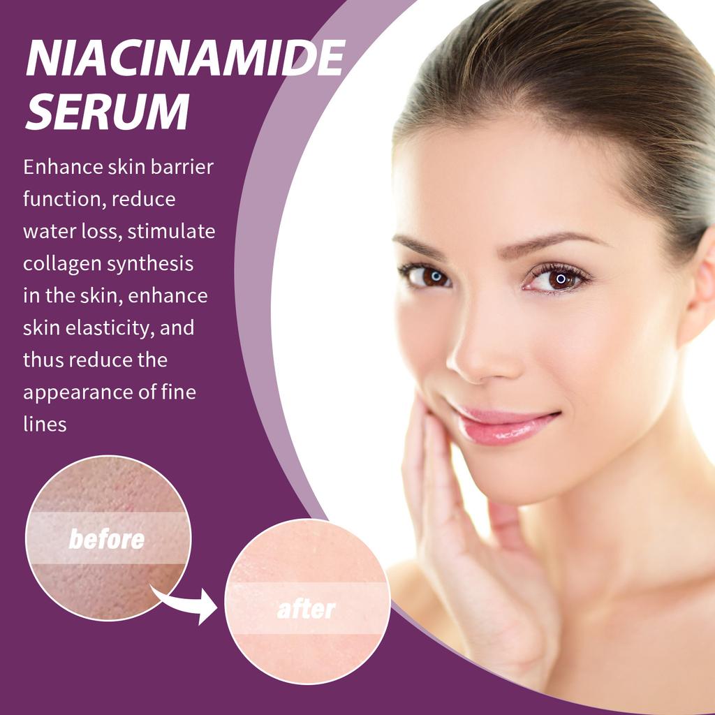 20% Niacinamide B3 Concentrated Skincare Anti Aging Color Removal Pore  Shrinking Spot Fading Wrinkles and Wrinkles 20ml