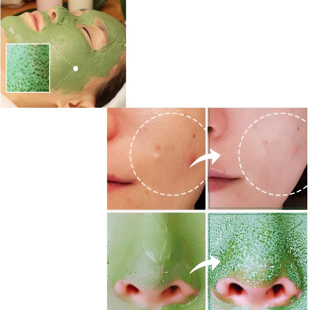 Medi-Pickme Spirulina Pore Mask Pack (100g)