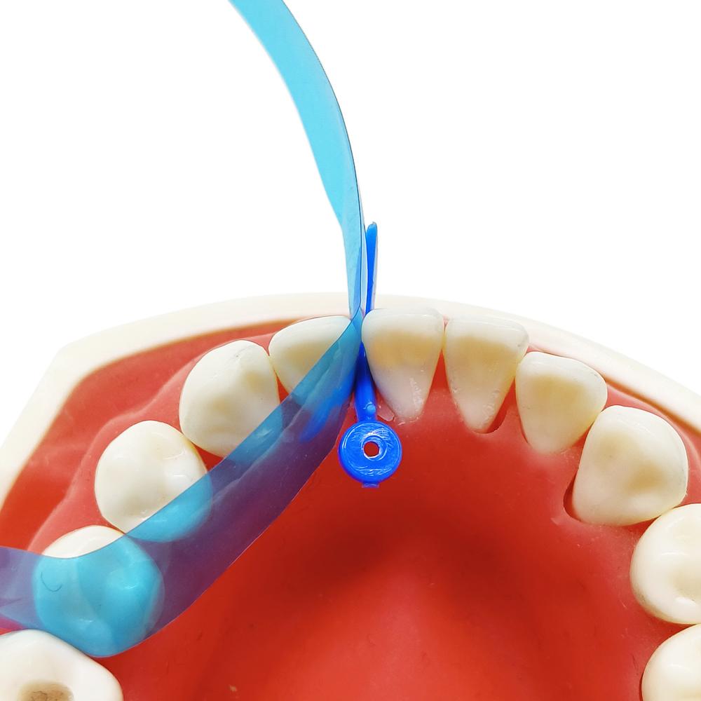 15 stücke oder 50 stücke Dental Konturierte Anterior Matrix Blau Transparent Anterior Polyester Streifen Dental Materialien Dicke 0,05mm
