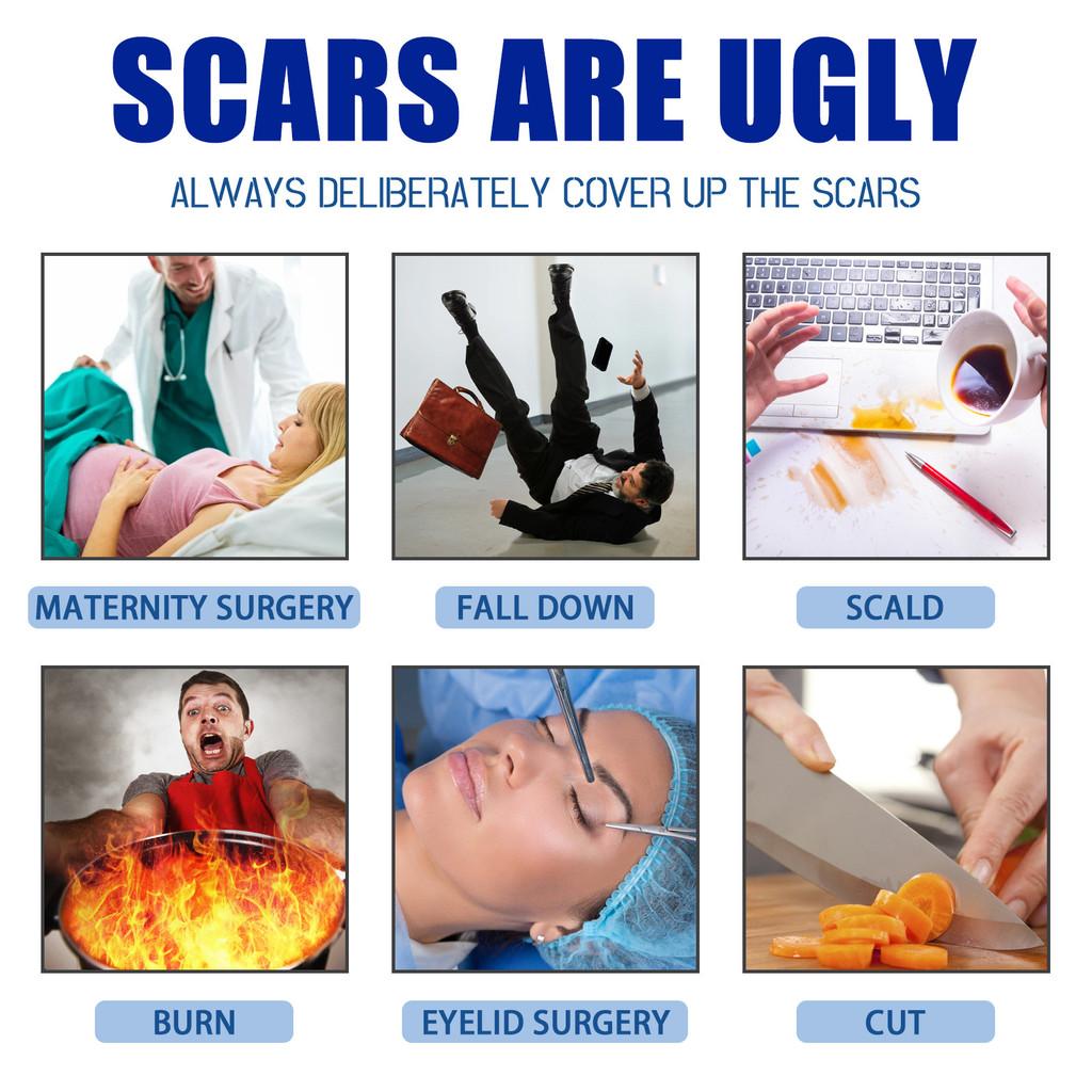 South Moon Scar Healing Gel With Soothing Formula For Burns Surgical Scars And Keloids