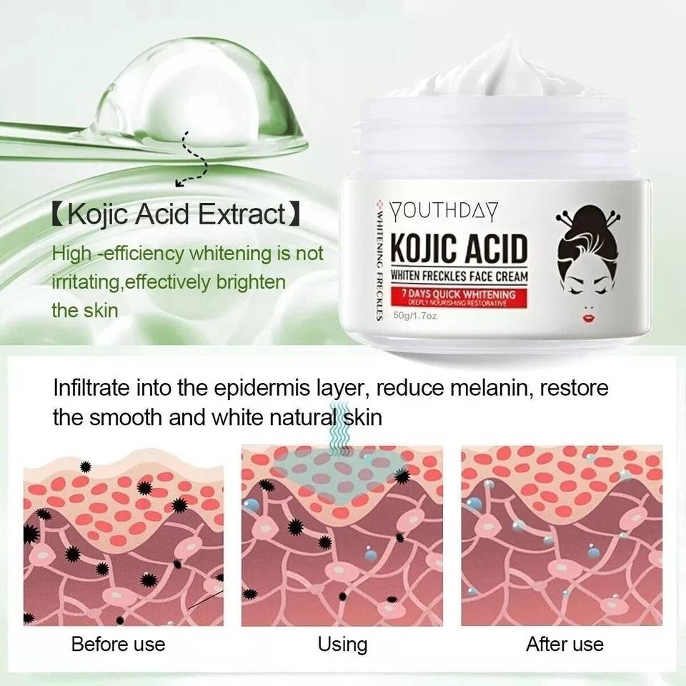 Kojic Acid Cream 50 ml (Pack of 5) | Instant Wrinkle Cream Eye Firming Anti-Aging Lifting Moisturizing Cream | For All Skin Types