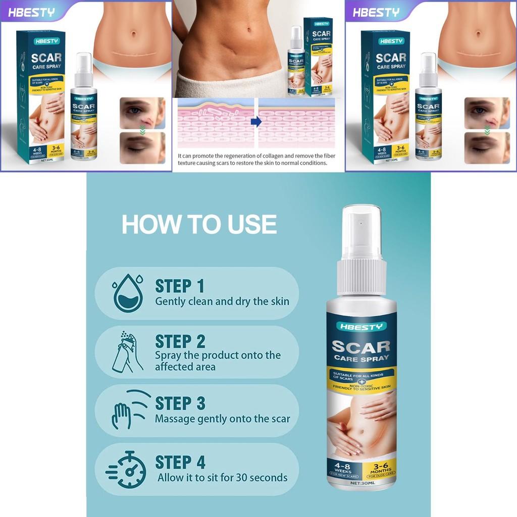 Hbesty Scar Spray Advanced Care For Postsurgical And Burn Recovery Suitable For All Types Skin