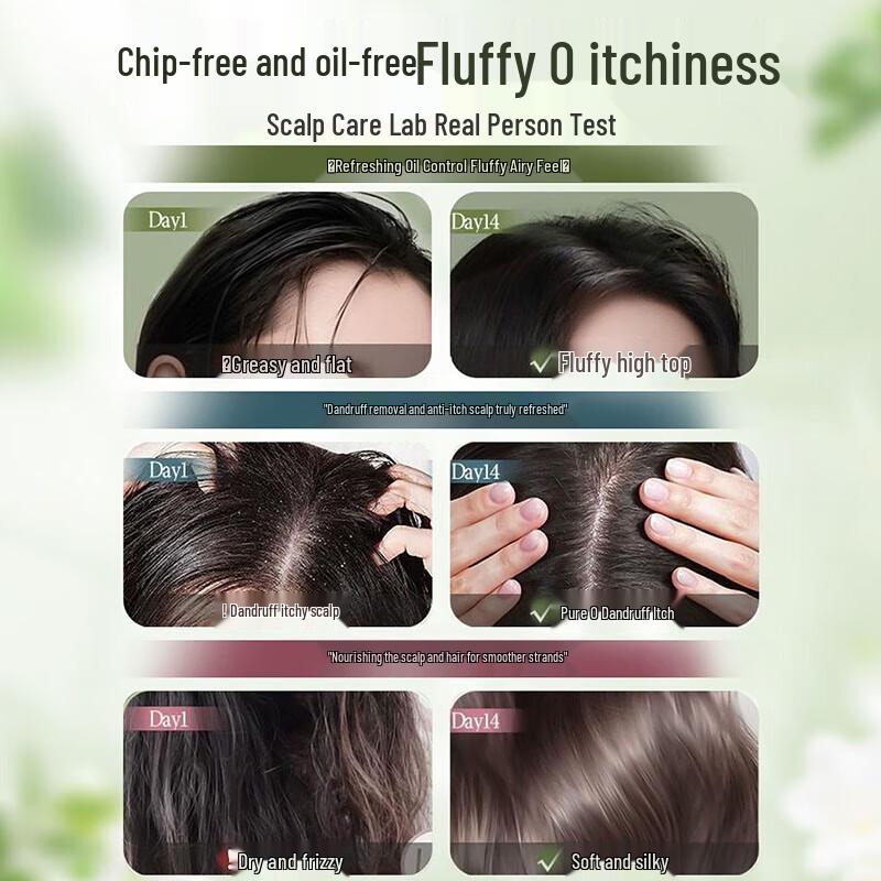 Little Dream Garden Oil Control & Anti-Dandruff Fragrance Shampoo