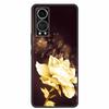 For ZTE Axon 30 5G Case Luxury Silicone TPU Soft Back Cover Phone Case For ZTE Axon 30 5G Coque Fashion A2322 Shockproof Funda