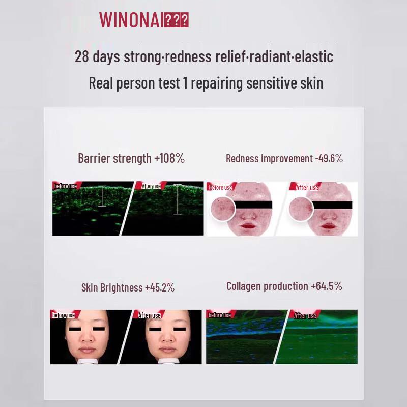 Winona Soothing and Moisturizing Special Care Essence (2nd Generation)