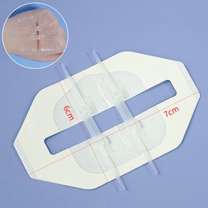 Plaster do zamykania ran na zamek błyskawiczny Plaster hemostatyczny Szybkie szwy na rany Bandaże przenośne na zewnątrz do pielęgnacji ran