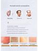 ZGTS192 Titanium Microneedle Derma Roller for Beauty Salon & Home Use