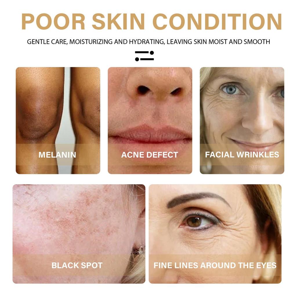 1/2/3/5pcs 30ml Turmeric Freckle Whitening Serum Curcumin Pigment Brighten Correcting Oil Spot B5C0