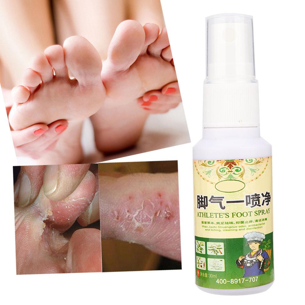 30ml Beriberi Removal Remove Foot Odor Sweat Antibacterial Bacteriostatic Plant Herb Spray