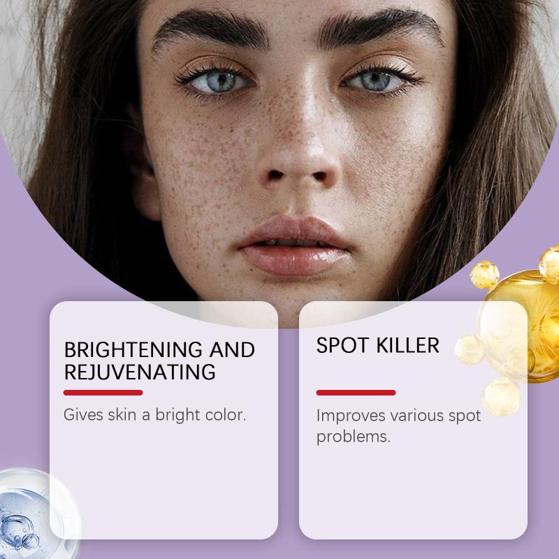 Retinol Whitening Freckle Cream Melasma Dark Spots Pigmentation Removal Fade Stain Melanin Fast Repair Brighten Korean Skin Care