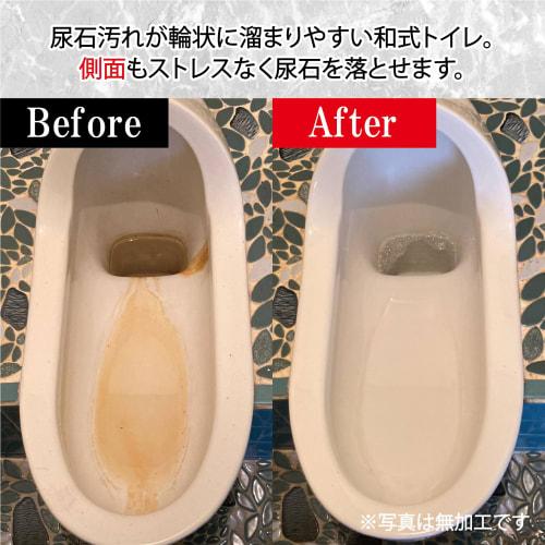 Sanki Professional Toilet Cleaner, Over 150,000 Bottles Sold, Used by Famous Hotels and Major Railway Companies, Restores Shine, Eliminates Stain, and