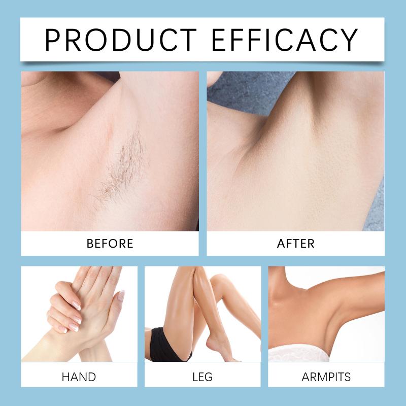 Redness Reducing Hair Remover Cream for Legs Arms Painless and Long Lasting Smooth Summer Skin Formula