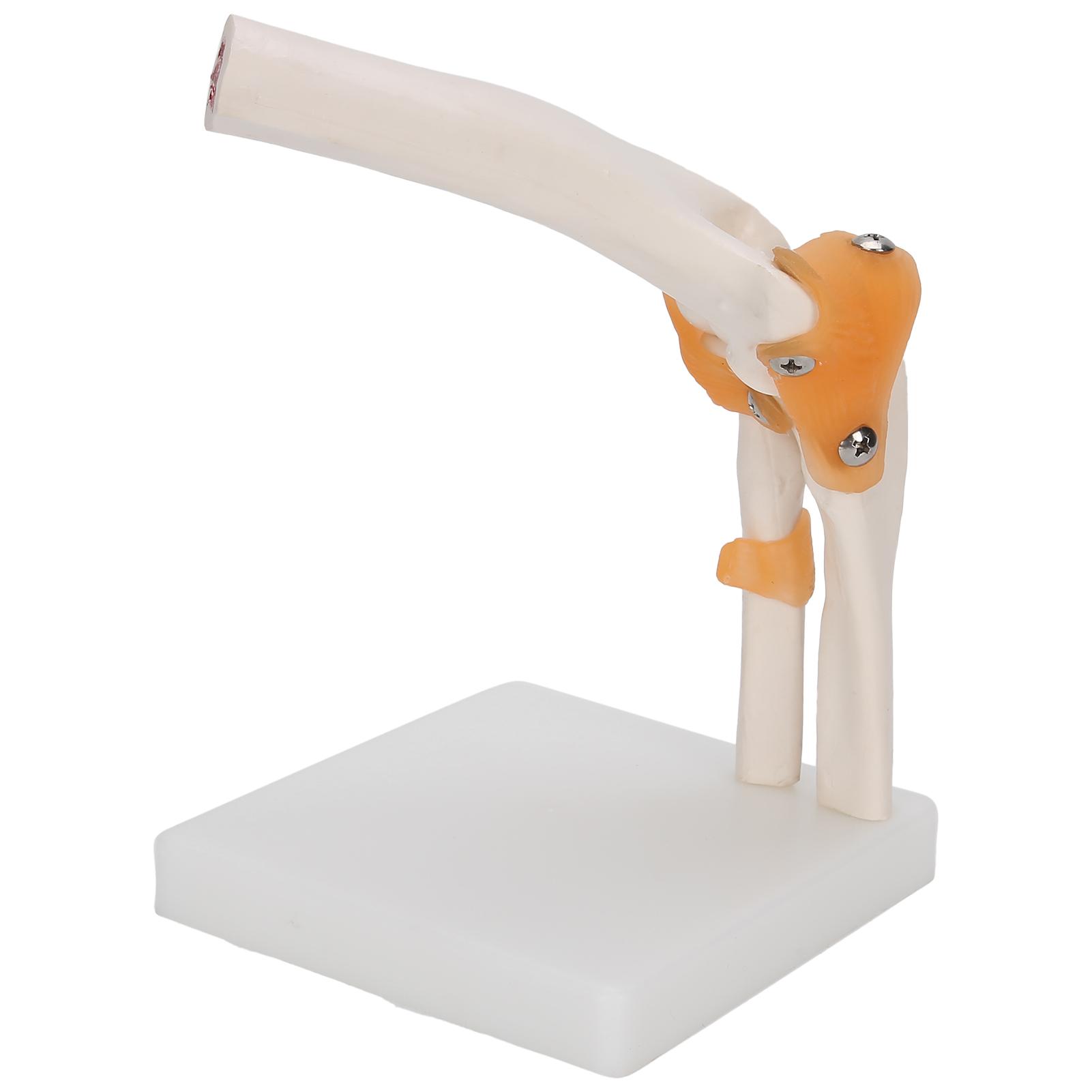 

Elbow Joint Model Life Size Accurate Elbow Skeleton Model for Study Display Teaching