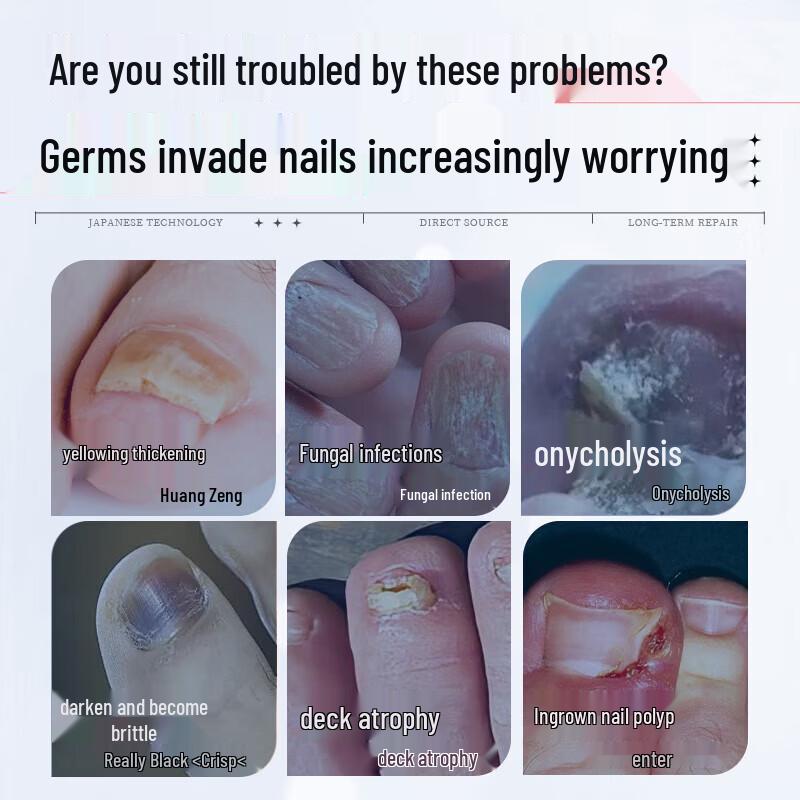 Longding Fungal Nail Repair Solution