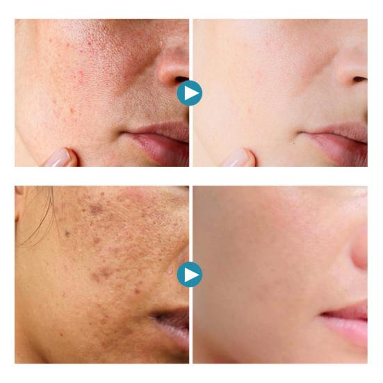 30ml Kyselina hyaluronová Pleťový krém Zpevňující pleť Zlepšuje elasticitu Přírodní extrakt Proti stárnutí Stahuje póry Krém proti vráskám pro ženy