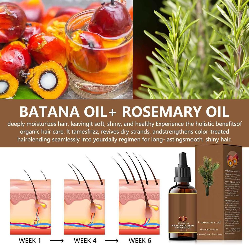 Rosemarypromotes Hair Growth And Strengthens Hair Care Essentialoil 30ml