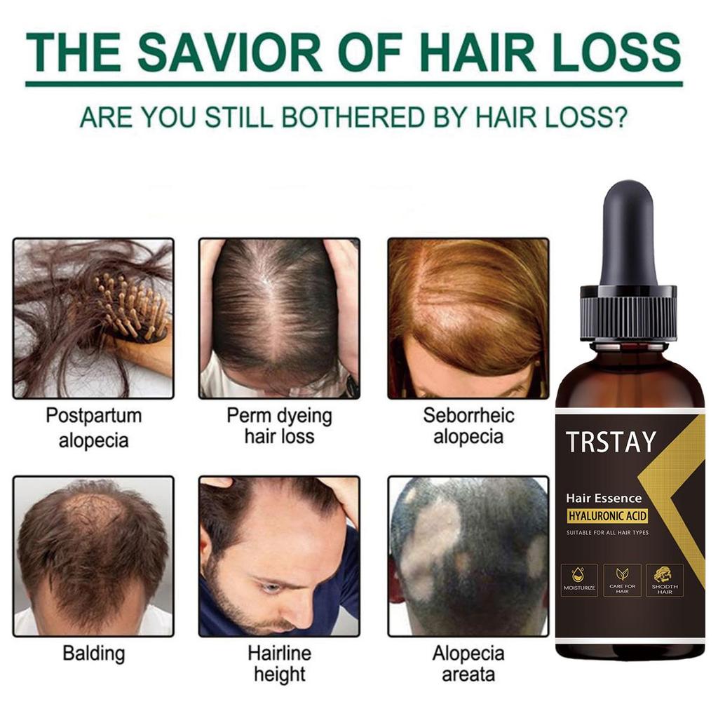 Ingweröl, natürliche Pflanzenessenz, Haarpflege für die Kopfhaut, Vorbeugung gegen Haarausfall, Essenzöl, frei von Haarausfall, Haarpflege- und Schönheitstool