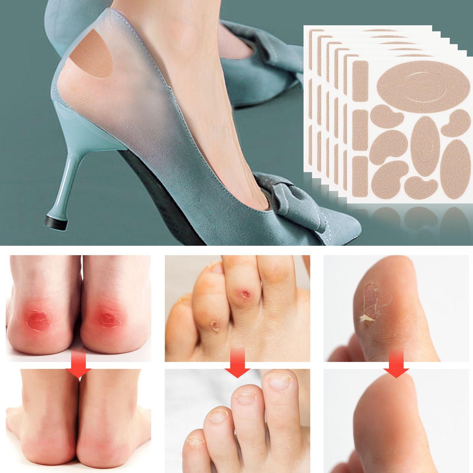 Антифрикционная лента для стопы — фото 3