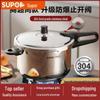 Supor 304 Stainless Steel Safe High-Pressure Cooker, Explosion-Proof, Fast Cooking, Compatible with Induction Cooktops.