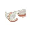 Modelo de Implante Dental 2 Implante Prótesis Completa Superior Inferior Modelo de Dientes Typodont Productos de Odontología Para Enseñanza Estudio