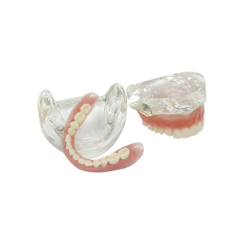 Modelo de Implante Dental 2 Implante Prótesis Completa Superior Inferior Modelo de Dientes Typodont Productos de Odontología Para Enseñanza Estudio