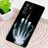 X-ray Hand Bones TPU Phone Case For Samsung Galaxy Note 10 Pro S26 S25 S24 S23 S22 Ultra Plus S21 FE S20 Shockproof Cover