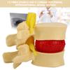 1:1.5 Lumbar Disc Herniation Demonstration Model Study Learn Human Spine