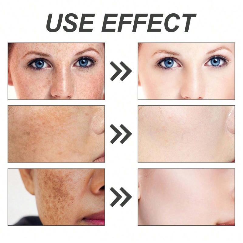 100 Grams of Kojic Acid Soap Gently Cleanses The Skin, Reduces Pigmentation, Brightens The Skin, Moisturizes and Cleanses Pores