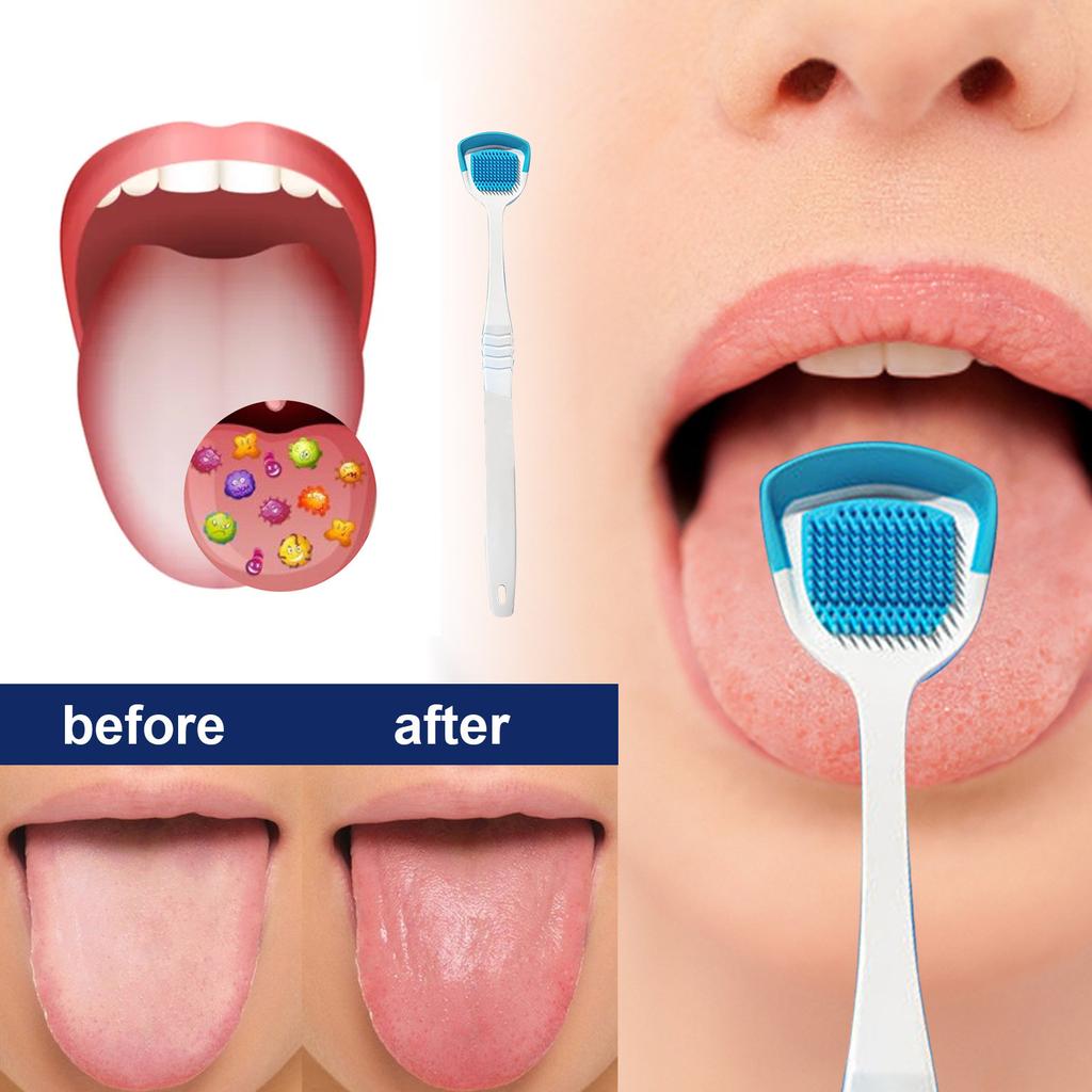 Soft Silicone Tongue Brush Tongue Coating Scraper Cleaning Toothbrush Mouth Fresh Breath Scraping Hygiene Oral Health Care