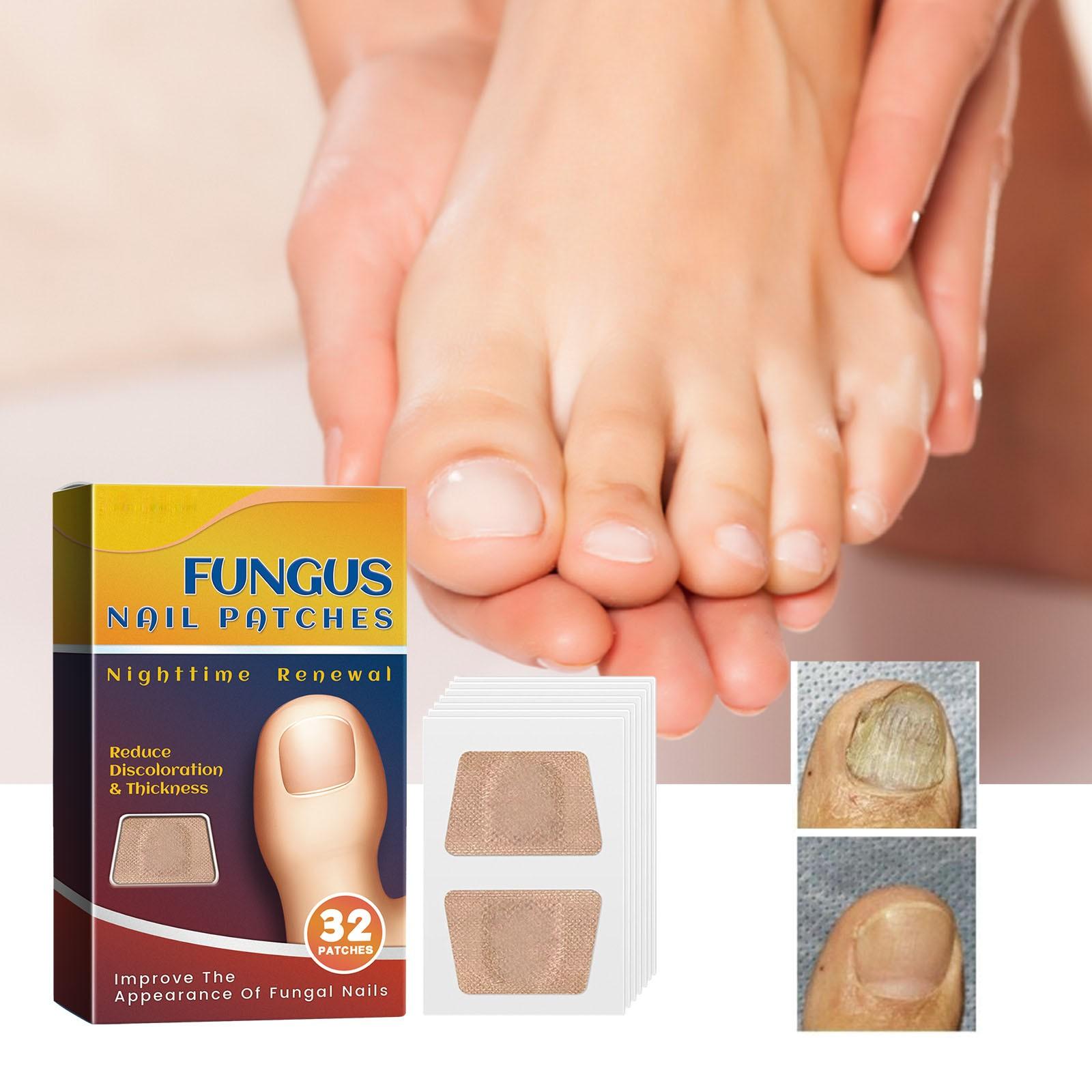 

Патчи для ухода за ногтями, Уход за ногтями, Уход за ногтями на ногах, Вросшие ногти, Коррекция мягких ногтей, Онихомикоз, Патчи для ухода за лаком для ногтей One Size