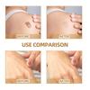 Skin Concealer Patch, Skin Scar Acne Mark Cover Patch Skin Color Patch Waterproof
